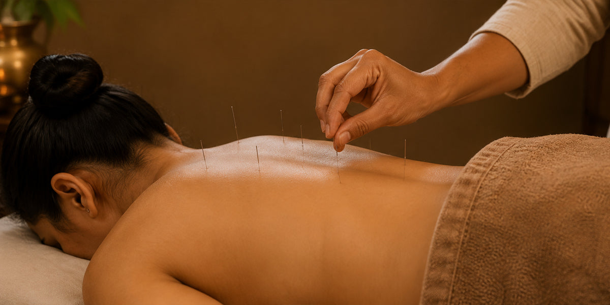 ACUPUNCTURE – Traditional Therapeutic Needle Therapy