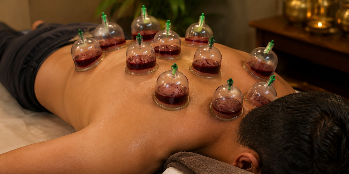 HIJAMA CUPPING – Wet Cupping Therapy